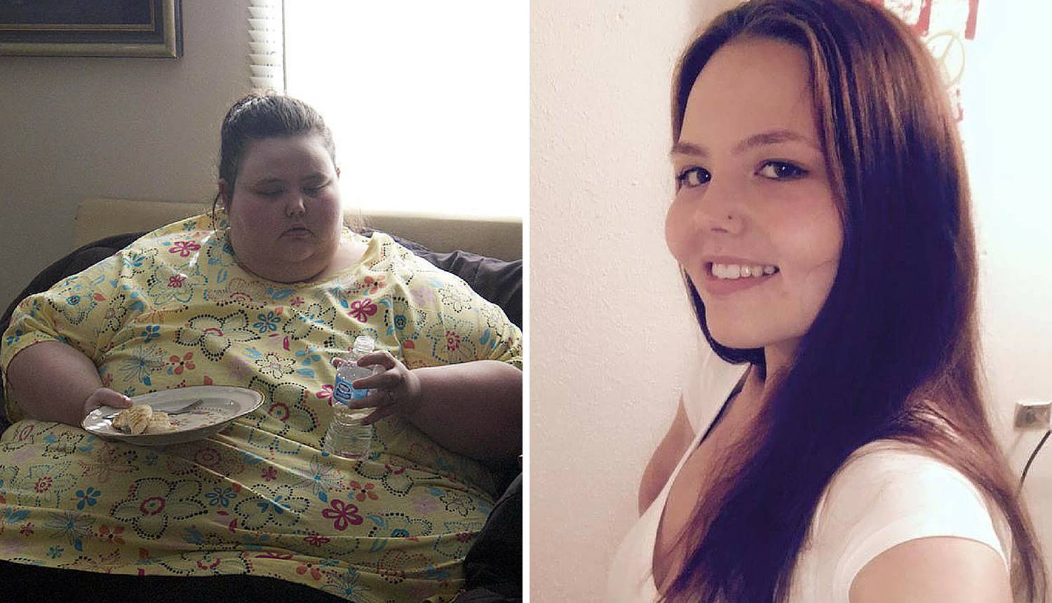 Smršavjela je 243 kg, sad je na putu da postane anoreksična