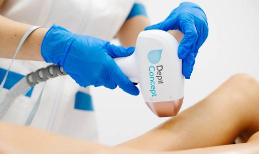 Lasersko uklanjanje dla&ccaron;ica: Kako je DepilConcept postao broj 1 u Splitu i Osijeku?