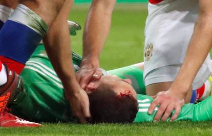 Teška ozljeda ruskog golmana: Španjolac mu je razbio glavu!