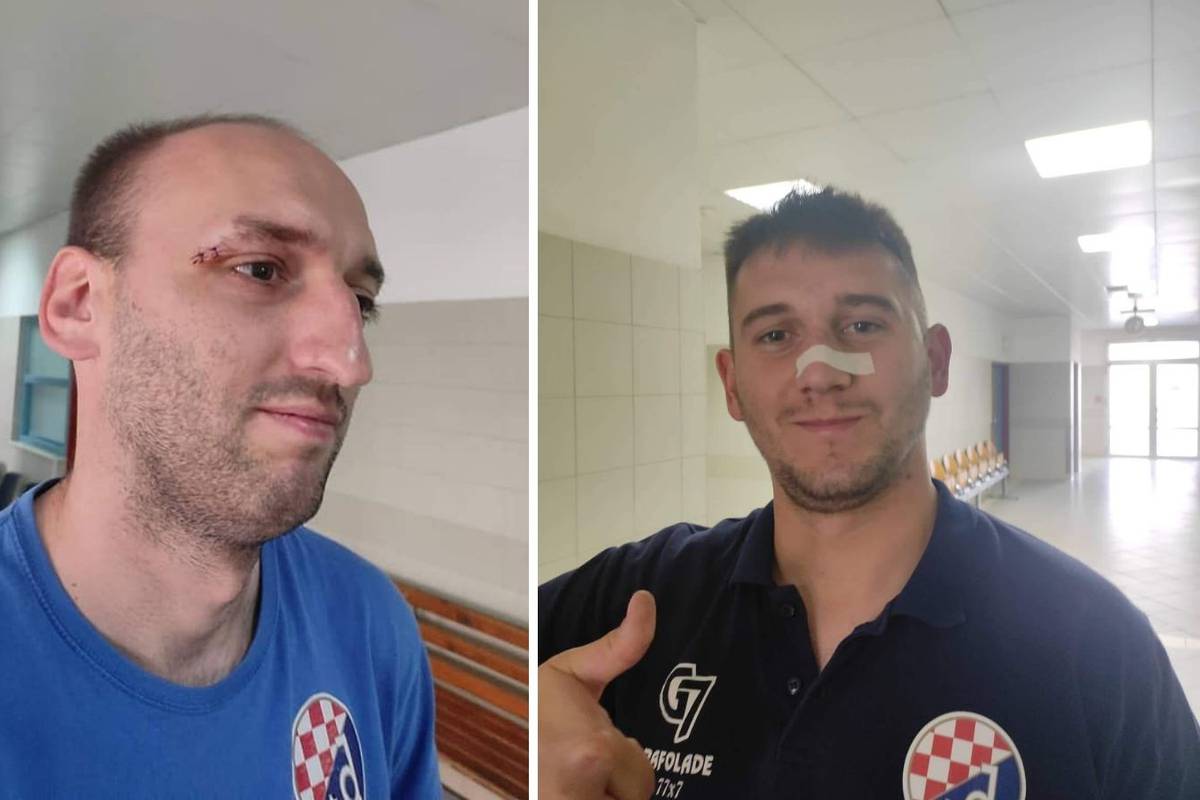 Ovo boli više od poraza: Igrači Dinama nakon utakmice završili u bolnici s razbijenim glavama