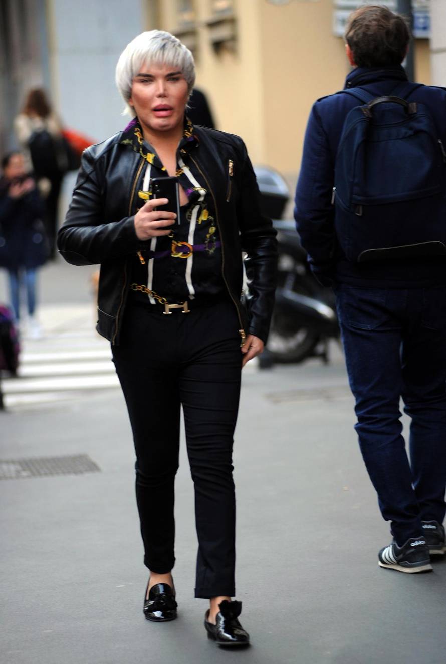 Milano: Rodrigo Alves nakon operacije brade