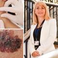 Sve o raku kože: Što povećava rizik od melanoma i koji ljudi moraju biti posebno oprezni