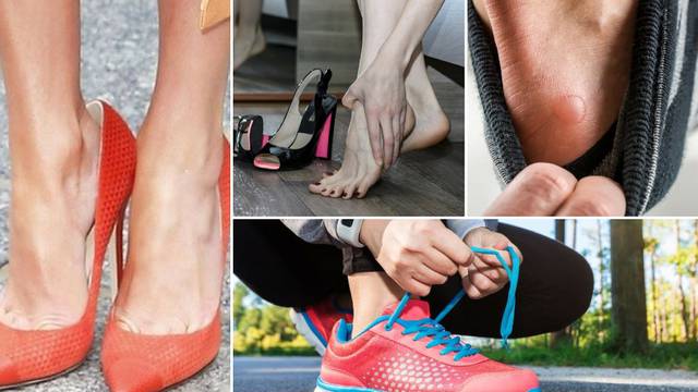 10 'sitnica' kojima si većina nas svaki dan uništava stopala