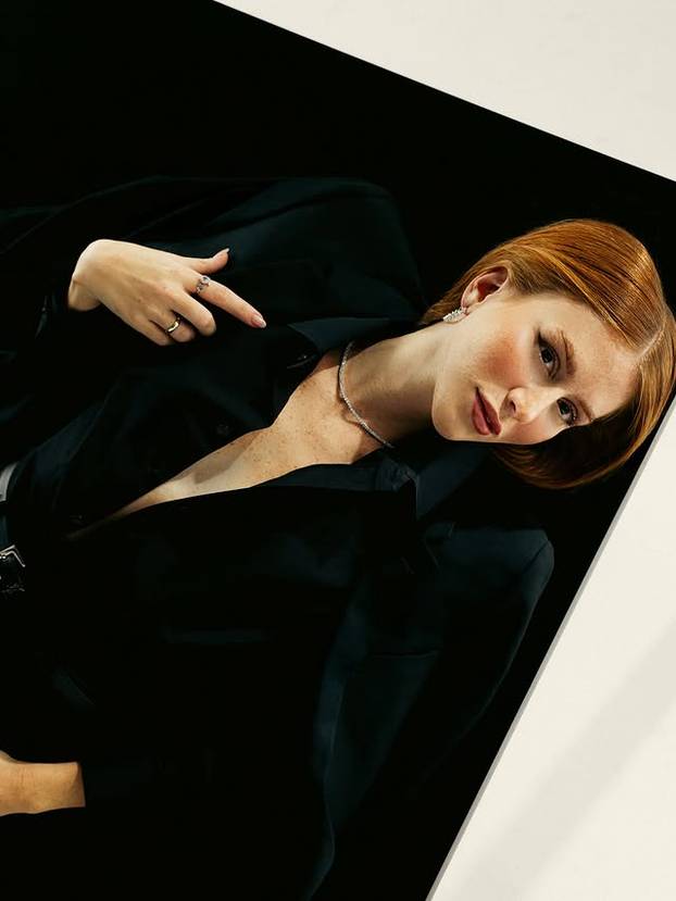 FOTO Posebna ljepota: Milijuni ljudi obožavaju njezine pjegice