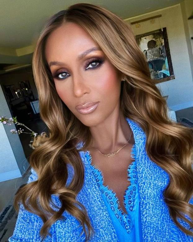 FOTO Klempave uši, razdvojeni zubi i 'šarena' koža: Evo koje su ljepotice unovčile svoje mane...