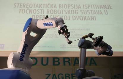 Hrvatski robot Ronna operirao pacijenta s tumorom na mozgu