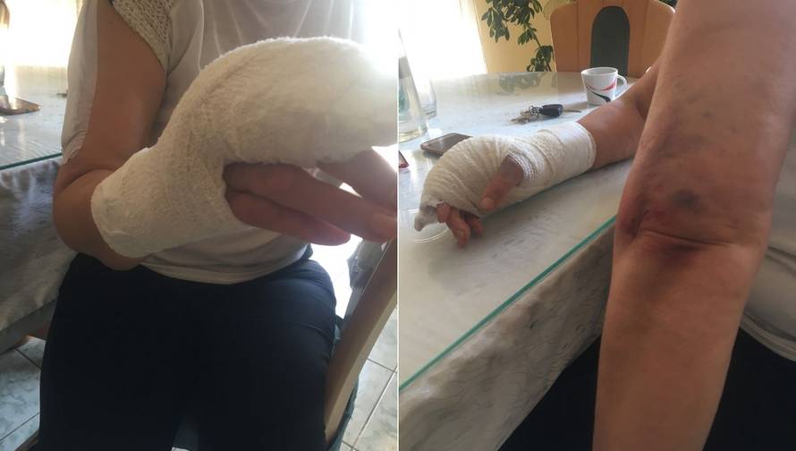 Manijak letvom udarao  trudnu ženu: Strah nas je, u šoku smo