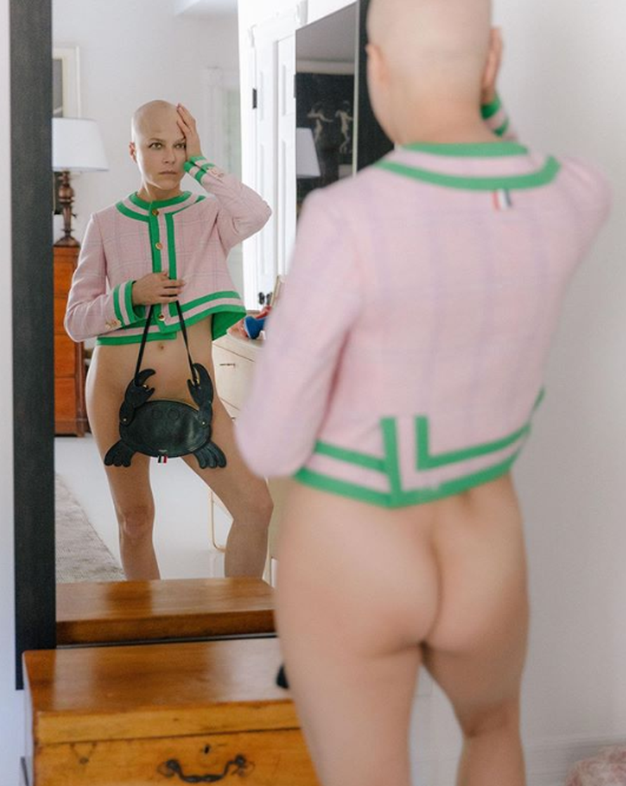 Borba s multiplom sklerozom: Blair opet šokirala fotografijom