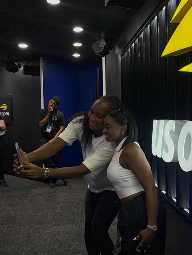 FOTO Olimpijska legenda: Imala sam tri plastične operacije. Za dvije ne biste mogli pogoditi...