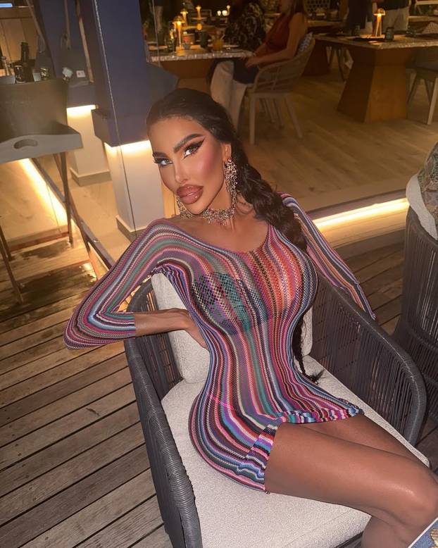 FOTO Potrošila više od 100 tisuća eura kako bi izgledala kao 'ljudska barbika' - Liječnici zgroženi