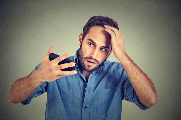 shocked man feeling head, surprised losing hair, receding hairline