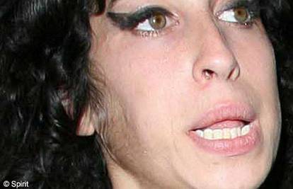 Amy Winehouse ima tijelo 40-godišnjakinje