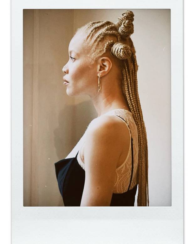 FOTO Afrikanka s albinizmom osvaja modnu industriju: 'Često privlačim znatiželjne poglede'