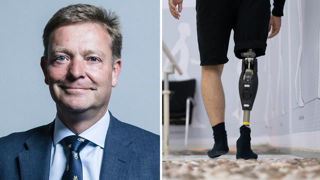Hrvatski stručnjaci o bioničkim protezama: Postat će standard