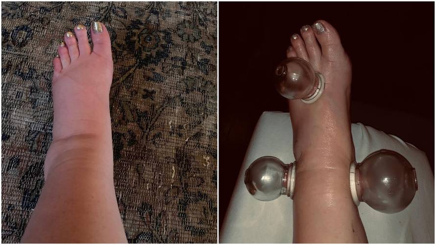 Očajna je zbog treće trudnoće: 'Nabila' je 40 kila i jedva hoda