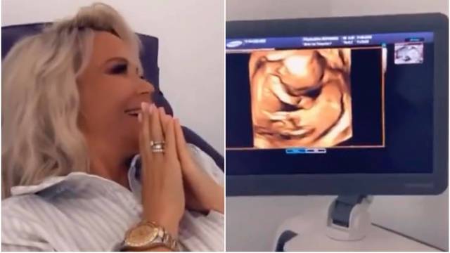 Maja pokazala ultrazvuk bebe: 'Što mislite je li cura ili dečko?'