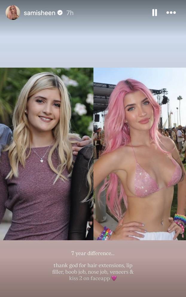 Njen tata kaže da je spavao s 47.000 žena: Otkrila što je sve operirala, voli biti u tangicama