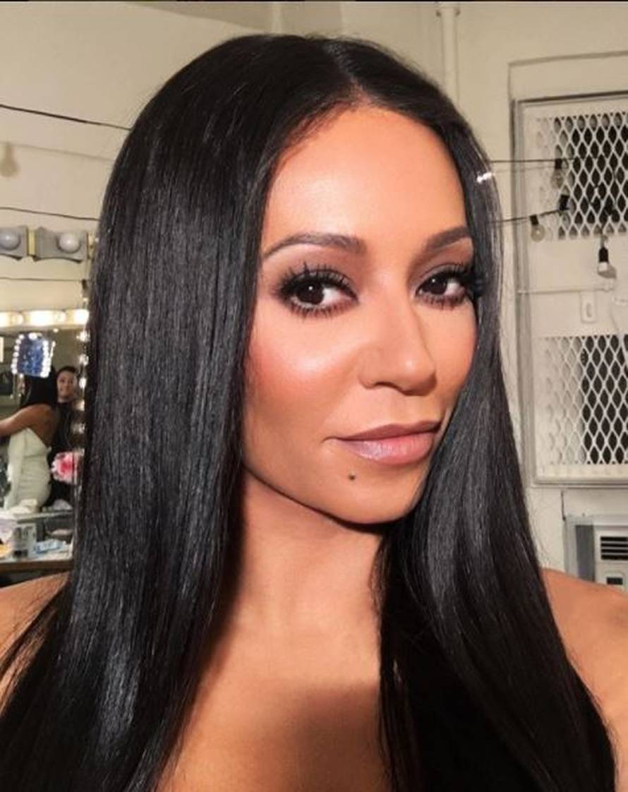 Mel B promijenila boju kože: 'Koji ku** si toliko bijela?'