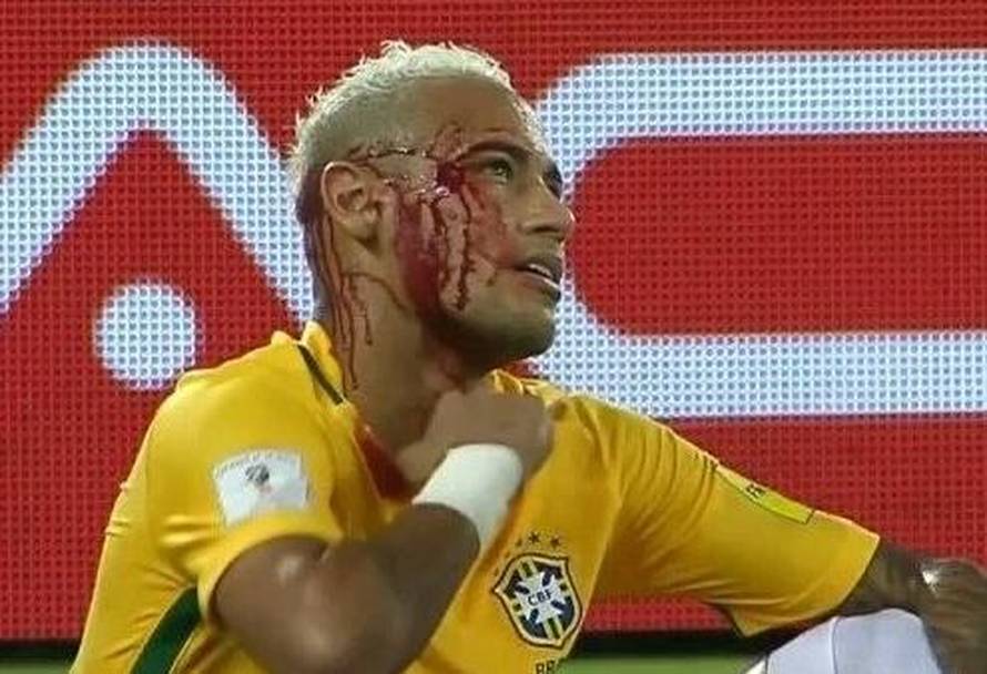 Krvario je za Brazil: Razbio je Boliviju, oni njemu razbili glavu