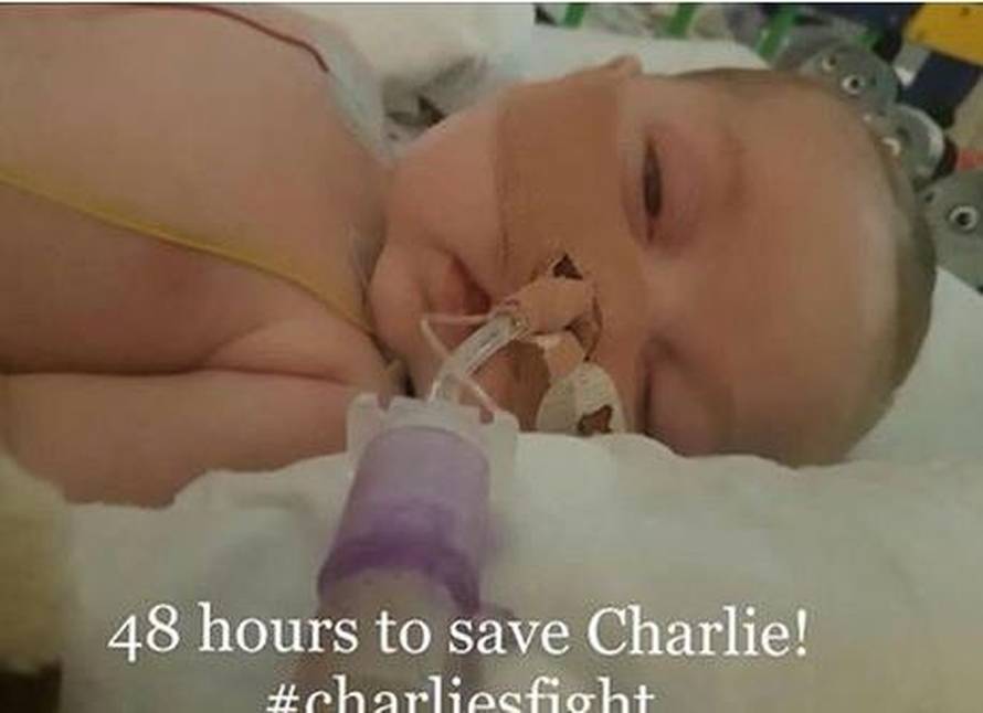 Tužan kraj: Isključili aparate, maleni Charlie umro u bolnici