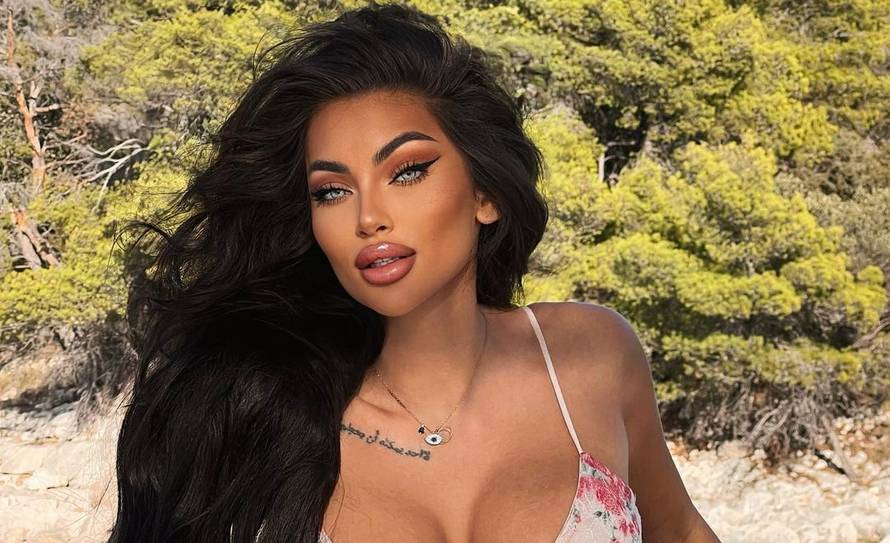 Hana iz 'Gospodina Savršenog' otkrila što je sve radila na licu: 'Znam da ste ovo dugo čekali...'