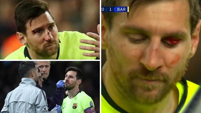 Leo Messi upoznao Smallinga: 'Krvari, znači da je ipak čovjek'