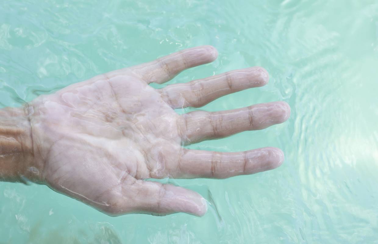 Znate li pravi razlog zašto se prsti smežuraju kada su u vodi?
