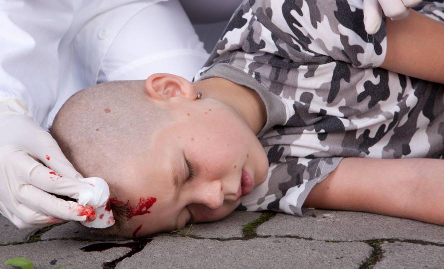 Udarci u glavu mogu biti uzrok oštećenja mozga, kome i smrti