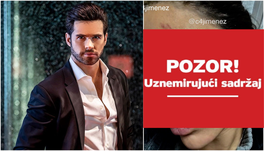 Meksički glumac pretukao curu: 'I dalje imam traume i ožiljke'