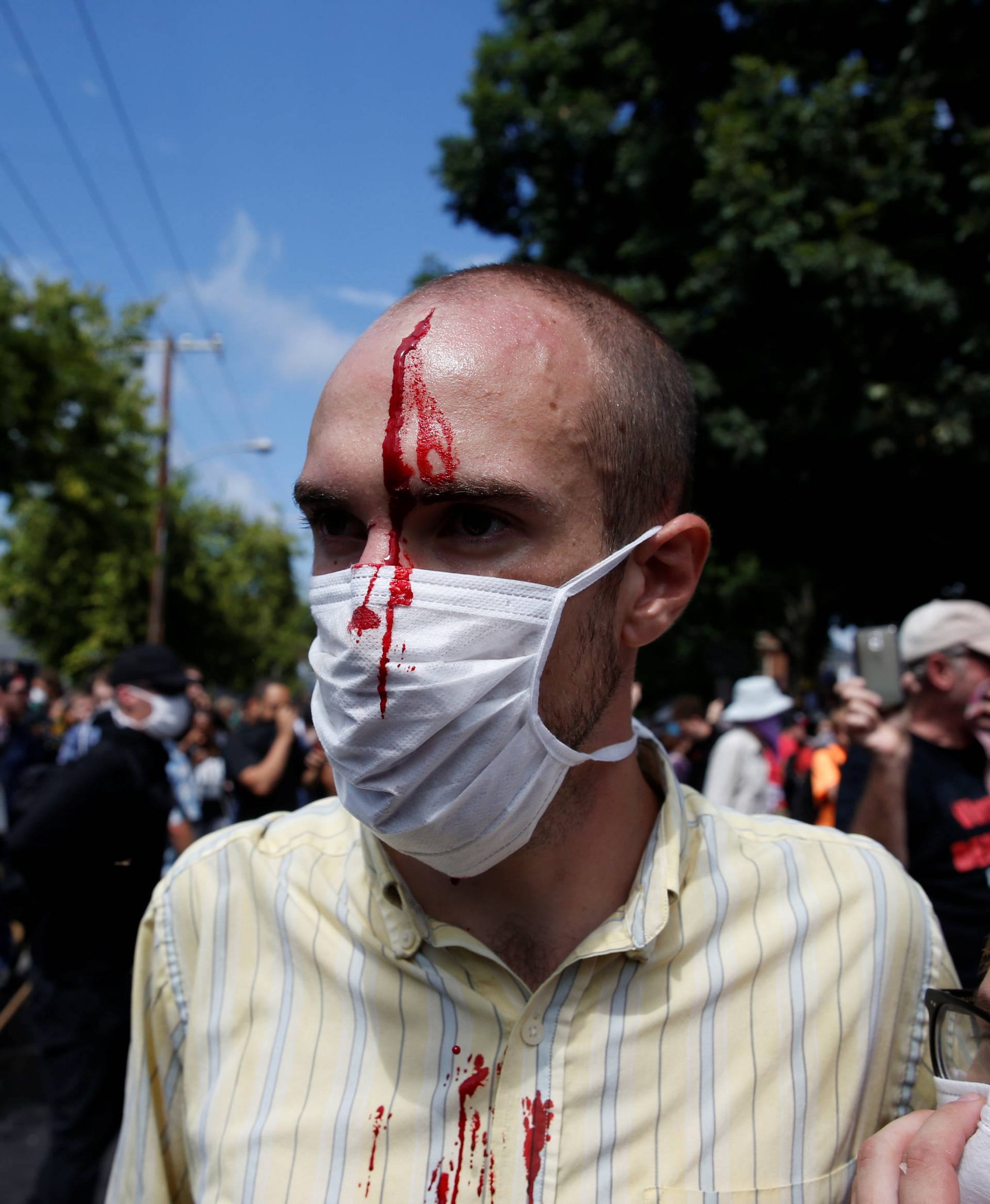 A man is seen with an injury during a clash between members of white nationalist protesters against a group of counter-protesters in Charlottesville