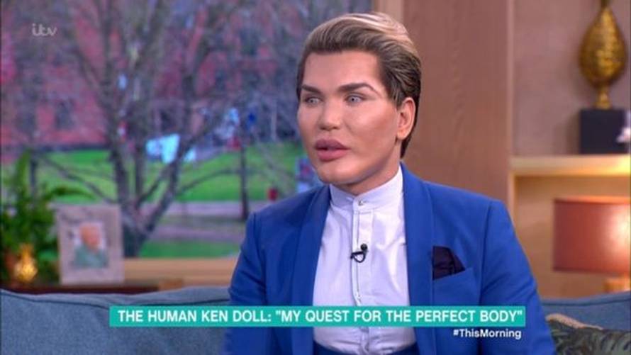 Šokirao svojim izgledom: Želi biti Ken, bio je na 50 operacija