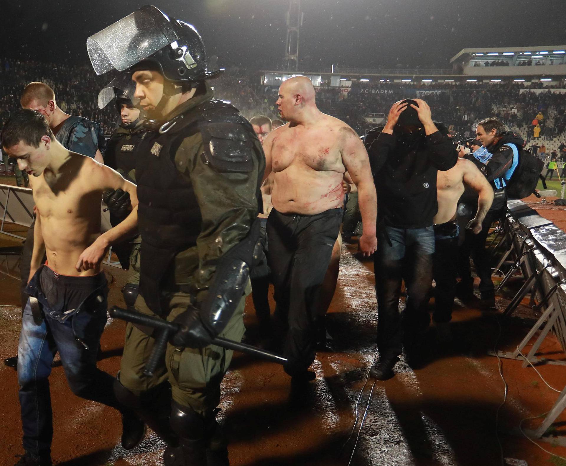 Police escort the soccer fans injured during the fights at a match between Red Star and Partizan in Belgrade