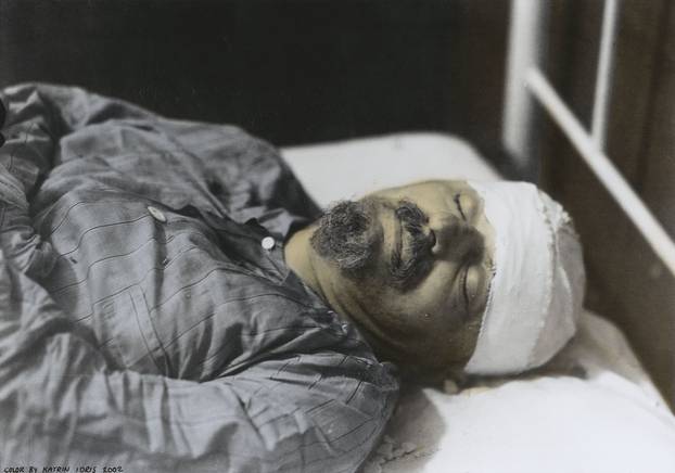 Trotzkij auf dem Sterbelager 1940