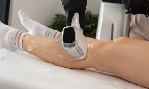 Revolucija u svijetu ljepote: Za&scaron;to je medicinski laser jedini pravi put do glatke ko&zcaron;e?