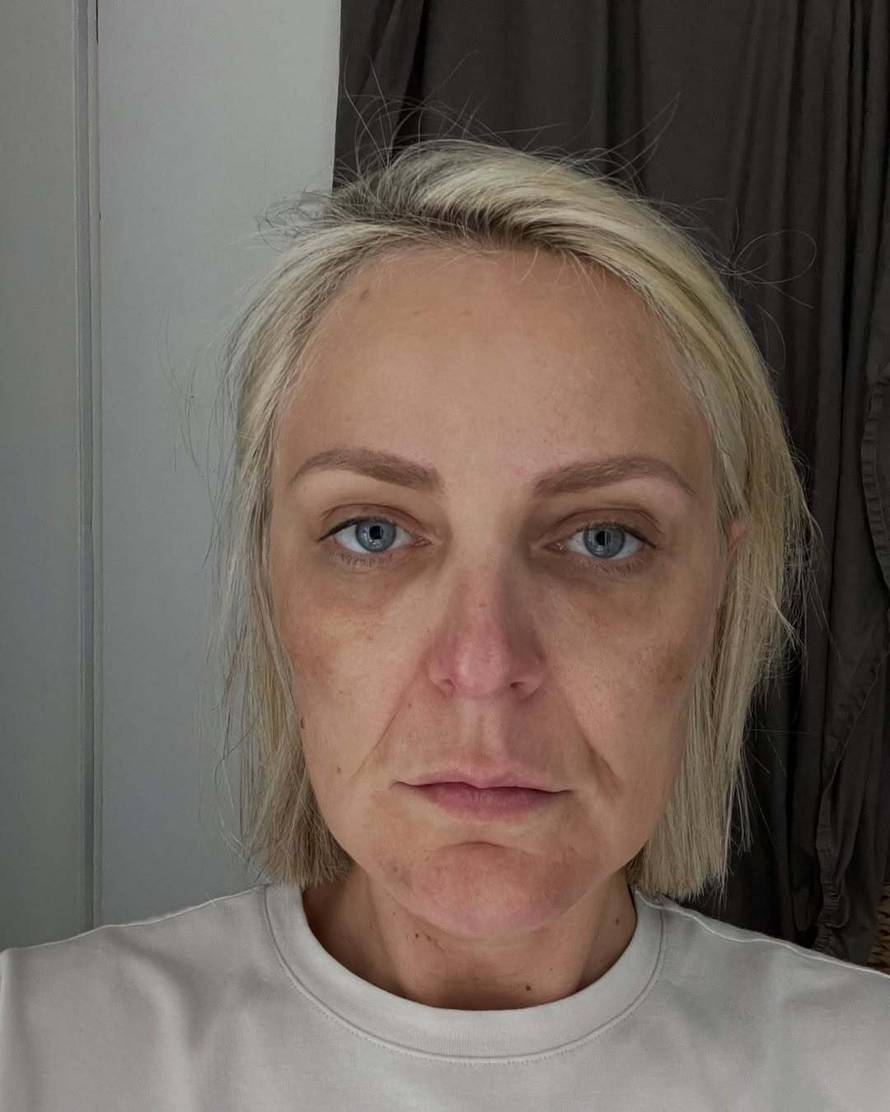 Stankica iz 'Savršenog': Traume od estetskih operacija su me potakle da učim za psihologa