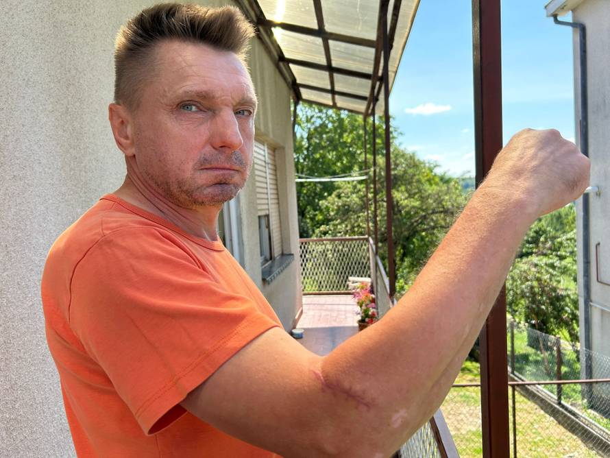 Muškarac kojeg je Pahoki tukao mjesec prije pokolja: 'Šivali su mi ruku, izlila se krv u mozak'