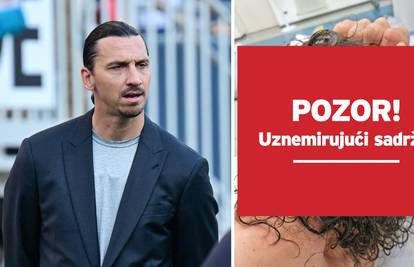 Ibrahimović rasjekao glavu. Objavio uznemirujuće fotke