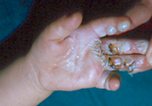 Strašne snimke iz Klaićeve. Evo zašto petarde ne davati djeci: Ostali bez prstiju, šake, vida!