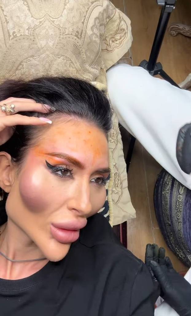 Žena s 'najvećim obrazima na svijetu' objavila fotografiju iz mladosti: 'Šok! Šteta ljepote'