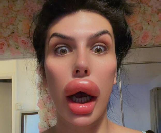 Woman with Britain's ‘biggest lips’ injects filler at HOME after being ‘refused’ by professionals – despite only taking six-week online course