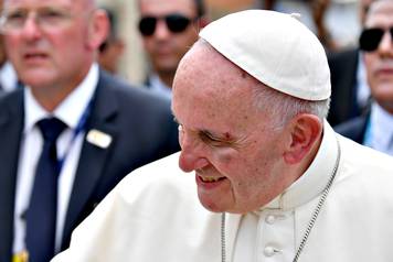 Pope Francis shows a bruise around his left eye during a visit to a neighbourhood in Cartagena