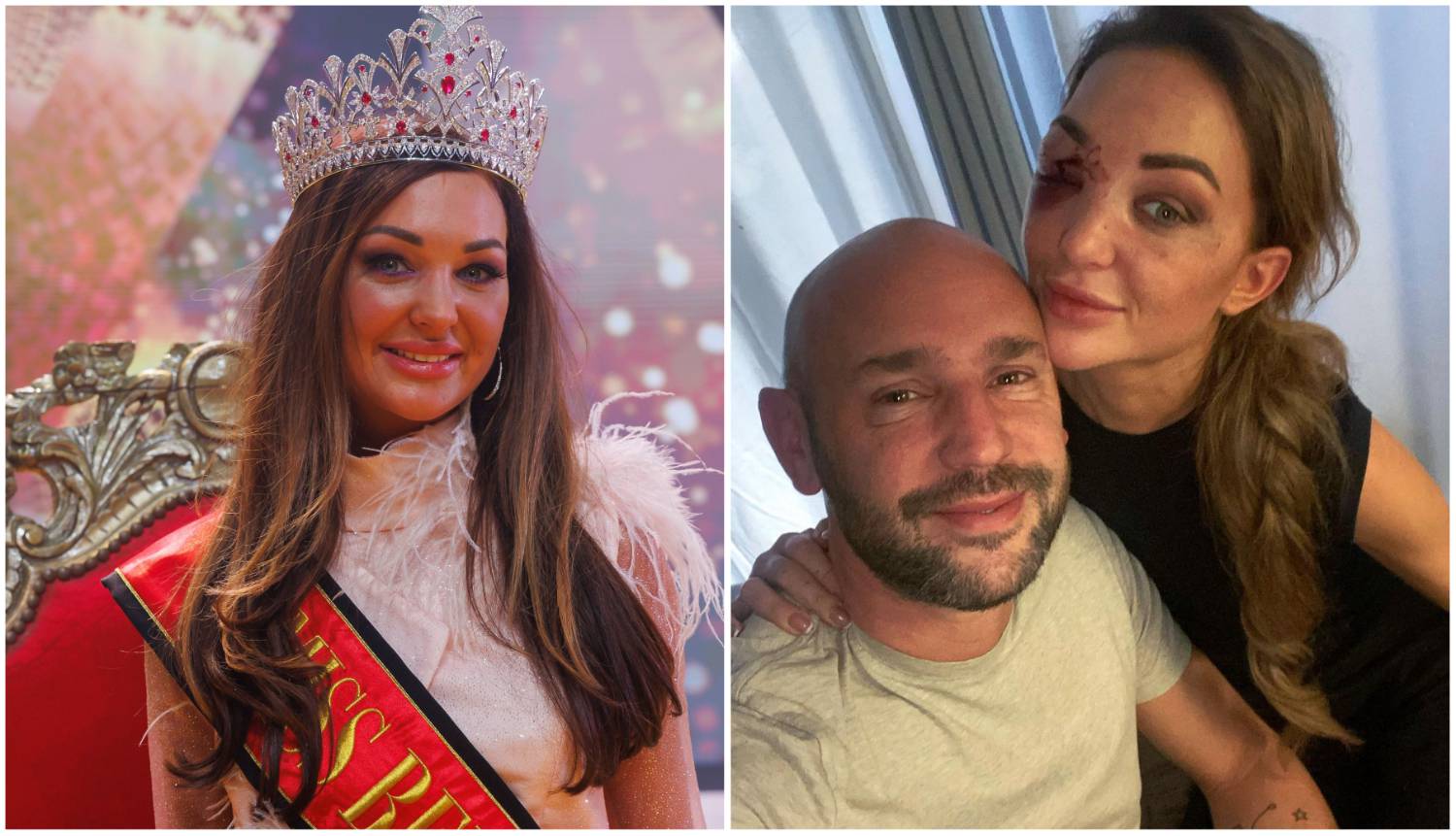 Miss Belgije imala prometnu, pola sata su je izvlačili iz auta