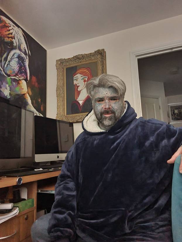 FOTO Više mu ne stane nijedna tetovaža! Uklonio je i bradavice. Evo kako je prije izgledao: Wow