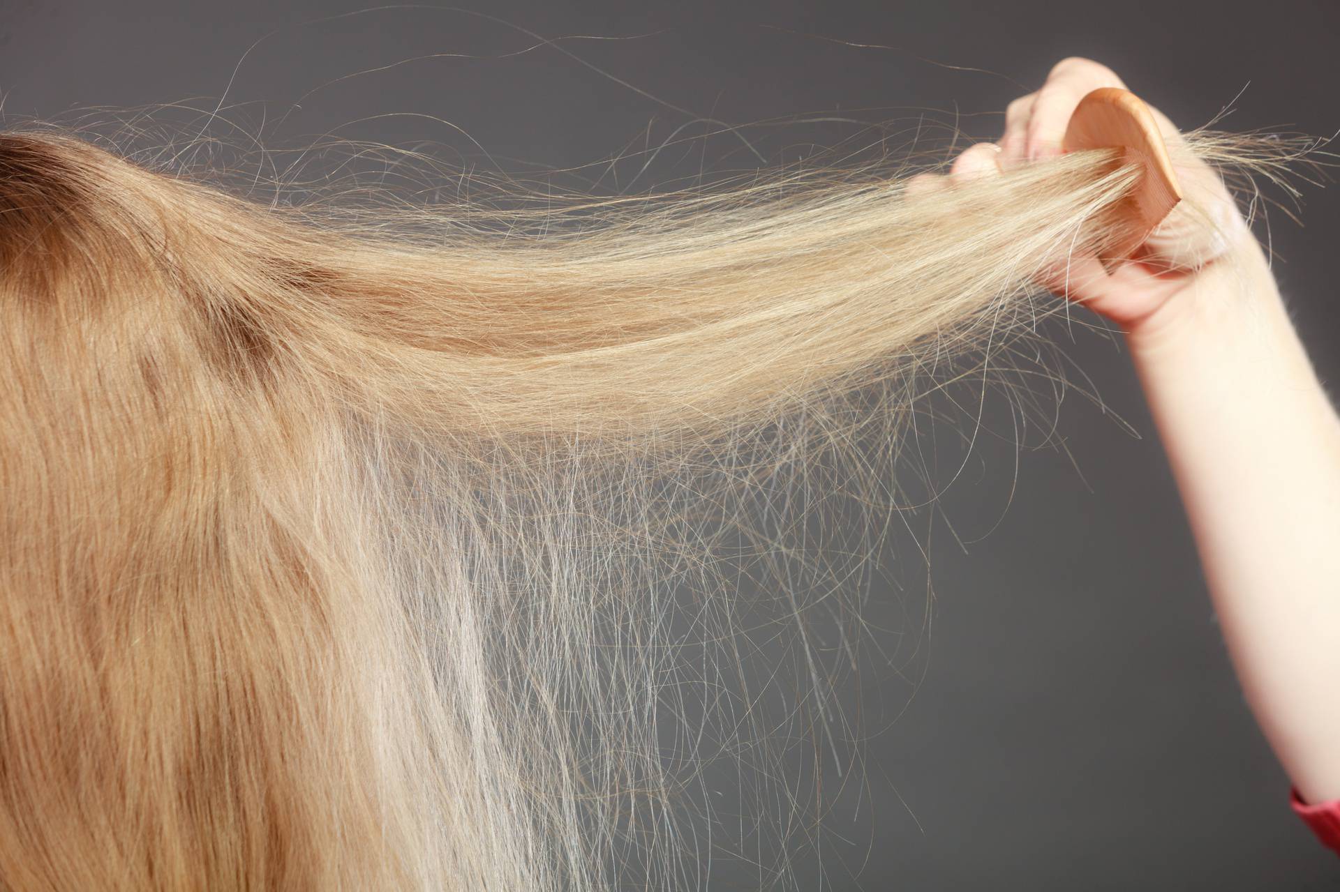 Zašto zimi naša kosa pojačano ispada? Zaustavite gubitak kose na vrijeme uz samo malo pažnje