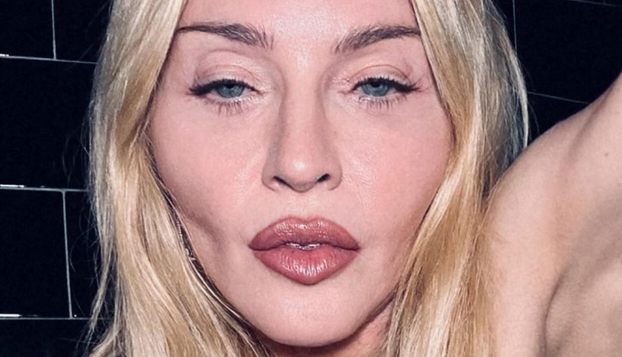 FOTO Zbog operacija postali neprepoznatljivi: Neke zvijezde su 'pod nož' išle čak 300 puta