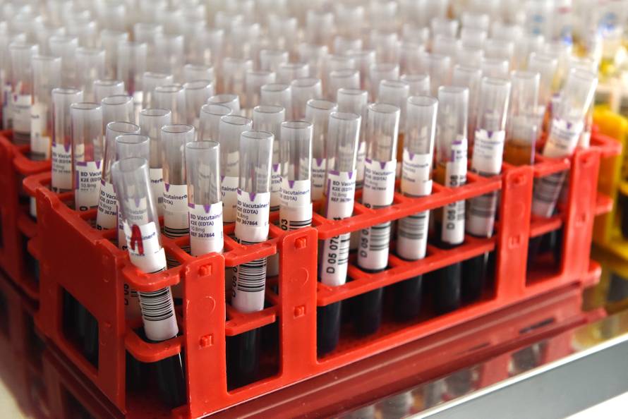 Hrvatski zavod za transfuzijsku medicinu i darivanje krvi