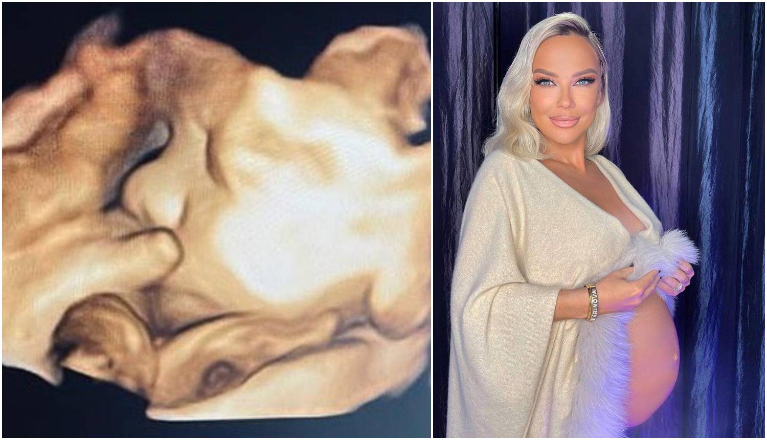Maja Šuput je podijelila sliku s ultrazvuka: 'Pametno mamino'