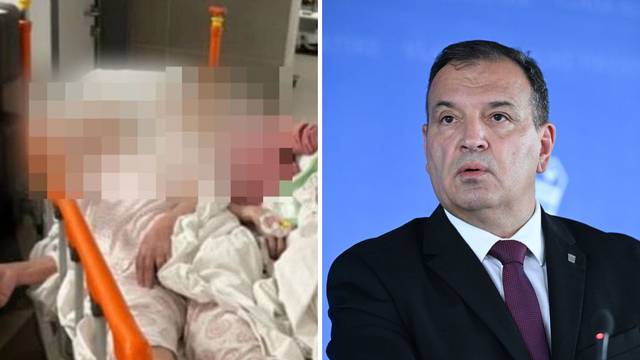 Beroš o slučaju iz bolnice Sisak, dvije žene stavili  u isti krevet: 'Ministar nije taj koji istražuje'