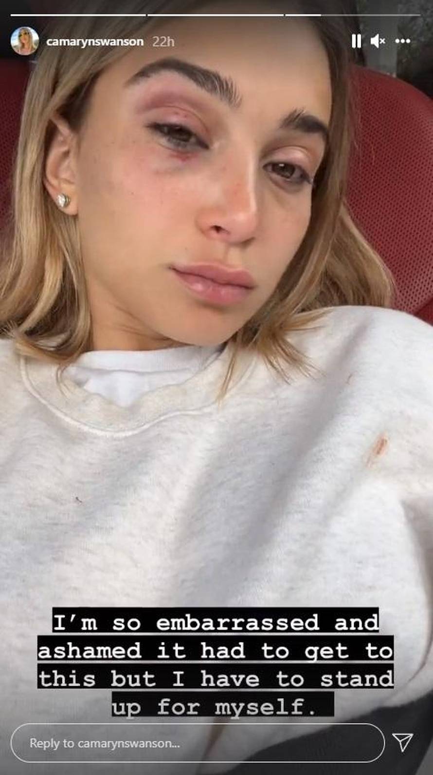 Repera Tygu uhitili zbog teškog obiteljskog nasilja: Poruke je nekoć slao Avi Karabatić i Soraji