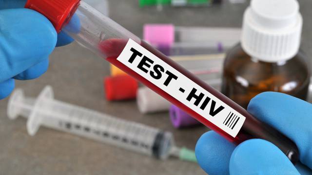 Otkrili novi soj HIV virusa u Nizozemskoj: 'VB varijanta'